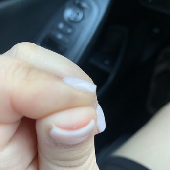 A T Nails - Finally after I got the bleeding to stop. - Nail Salons Near Me - Santa Ana, California A T Nails - Finally after I got the bleeding to stop. - Nail Salons Near Me - Santa Ana, California