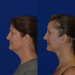 Egozi Plastic Surgery