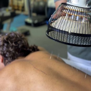 Cha Physical Therapy, PC - Acupuncture is an eastern medical practice that has proven effects on the body and the mind. Release with a breathtaking experience. - Physical Therapy Near Me - New York, New York Cha Physical Therapy, PC - Acupuncture is an eastern medical practice that has proven effects on the body and the mind. Release with a breathtaking experience. - Physical Therapy Near Me - New York, New York