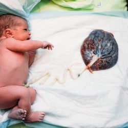 UMA Midwifery & Holistic Services - Homebirth& placenta Encapsulation Services