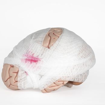 Harmonized Brain Centers - Concussions can occur in any sport and at any age. We can HELP! - Counseling & Mental Health Near Me - Colorado Springs, Colorado Harmonized Brain Centers - Concussions can occur in any sport and at any age. We can HELP! - Counseling & Mental Health Near Me - Colorado Springs, Colorado