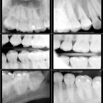 Melody Dental Care - XRAYs and PANOs are taken here! - General Dentistry Near Me - Riverside, California Melody Dental Care - XRAYs and PANOs are taken here! - General Dentistry Near Me - Riverside, California