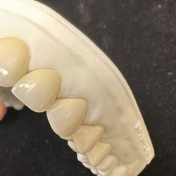 Boca Raton Cosmetic Dentist