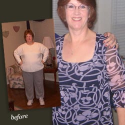 Dallas Bariatric Center - LAP-BAND® Patient