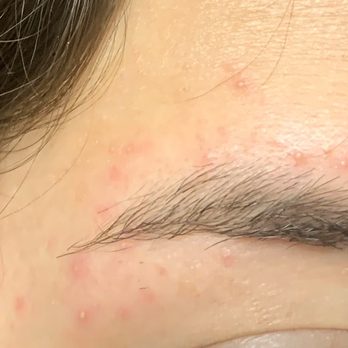 Grace Threading - The reaction of my skin after my visit, I've NEVER in ten years had a reaction with threading before. EVER - Hair Removal Near Me - San Diego, California Grace Threading - The reaction of my skin after my visit, I've NEVER in ten years had a reaction with threading before. EVER - Hair Removal Near Me - San Diego, California