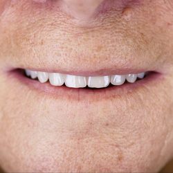 Aesthetic Denture Clinic