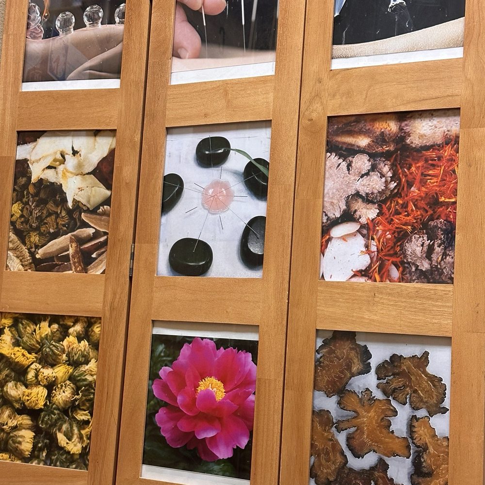 Forestream Acupuncture & Herbs - Accupuncture. - Acupuncture Near Me - Santa Rosa, California