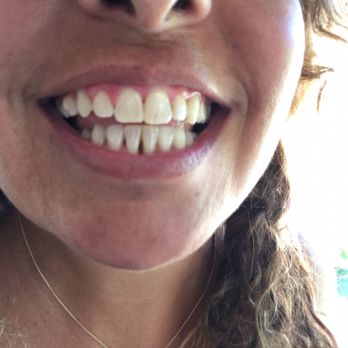 Aesthetics & Essentials Dental Group - General Dentistry Near Me - Mountain View, California Aesthetics & Essentials Dental Group - General Dentistry Near Me - Mountain View, California