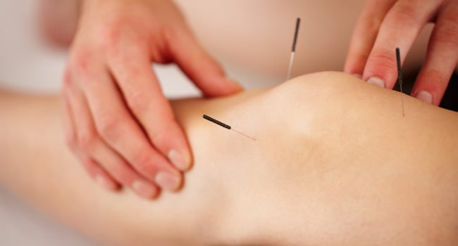 China Acupuncture Clinic