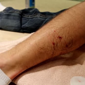Gary A. Peterson | Personal Injury Attorney - Dog Bite Attorney - Personal Injury Law Near Me - Tustin, California Gary A. Peterson | Personal Injury Attorney - Dog Bite Attorney - Personal Injury Law Near Me - Tustin, California