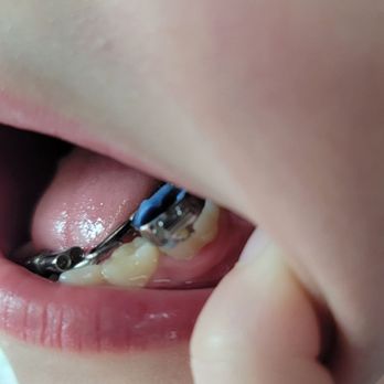 Towne Dental & Orthodontics - General Dentistry Near Me - Waller, Texas Towne Dental & Orthodontics - General Dentistry Near Me - Waller, Texas
