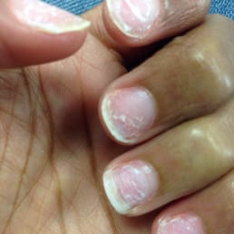 My nails are in pain