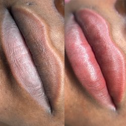 Moon Beauty - Dark lip neutralization