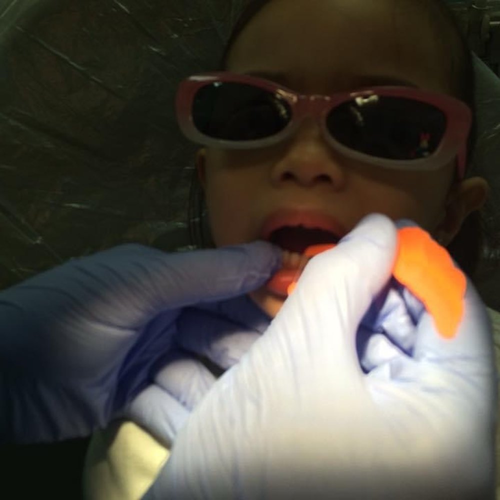 Rocky C Baysa, DMD - Flossing her teeth by Dr. Rocky - Endodontists Near Me - Vallejo, California Rocky C Baysa, DMD - Flossing her teeth by Dr. Rocky - Endodontists Near Me - Vallejo, California