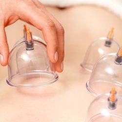 Royal Massage - Cupping