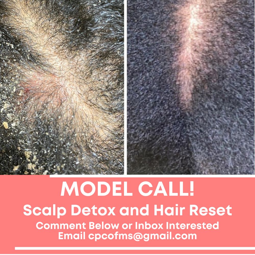 THE CRANIAL PROSTHESIS CENTER OF MISSISSIPPI 717 Rice Rd, Ridgeland, Mississippi Hair Loss