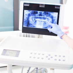 Martin Dentures and Implants