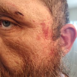 Arrowhead Hospital - Punched in the face by security for no reason wanting to get home to my dogs