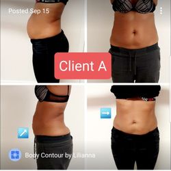 Body Contour By Lilianna - This is the clients results that left a negative review. Claims no results but photos show a different story.