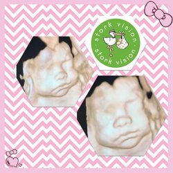 Stork Vision - 3D Ultrasound from San Antonio location