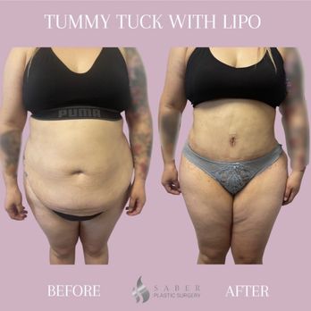 Saber Plastic Surgery - Plastic Surgeons Near Me - Encino, California Saber Plastic Surgery - Plastic Surgeons Near Me - Encino, California