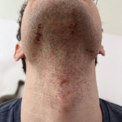 Gentleman's Quarters Barbershop - Update: 2 days after
