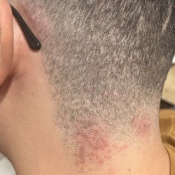Gentlemen's League Barbershop - The machine that was used on me was dull and kept ripping out hair it was clearly not sanitized properly as it gave me a skin infection.