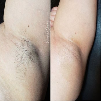 HoneyBe Gorgeous - Underarm Wax - Waxing Near Me - Austin, Texas