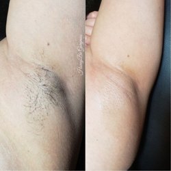 HoneyBe Gorgeous - Underarm Wax