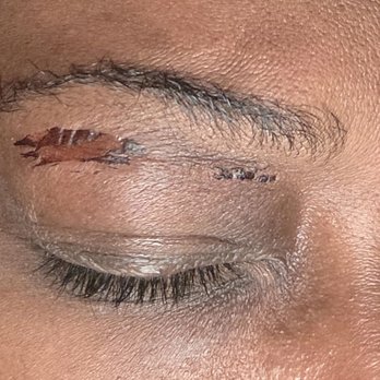 Ideal Brows Threading And Waxing - This is what it looked like by Sunday. - Waxing Near Me - Montclair, California Ideal Brows Threading And Waxing - This is what it looked like by Sunday. - Waxing Near Me - Montclair, California