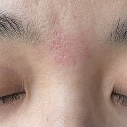 First Time Special Eyelash Lift and Tint and Eyebrow Wax (My skin gets naturally red after a wax so ignore that lol) First Time Special Eyelash Lift and Tint and Eyebrow Wax (My skin gets naturally red after a wax so ignore that lol)