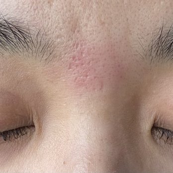Bell’s Lashes - First Time Special Eyelash Lift and Tint and Eyebrow Wax (My skin gets naturally red after a wax so ignore that lol) - Eyelash Service Near Me - West Covina, California Bell’s Lashes - First Time Special Eyelash Lift and Tint and Eyebrow Wax (My skin gets naturally red after a wax so ignore that lol) - Eyelash Service Near Me - West Covina, California