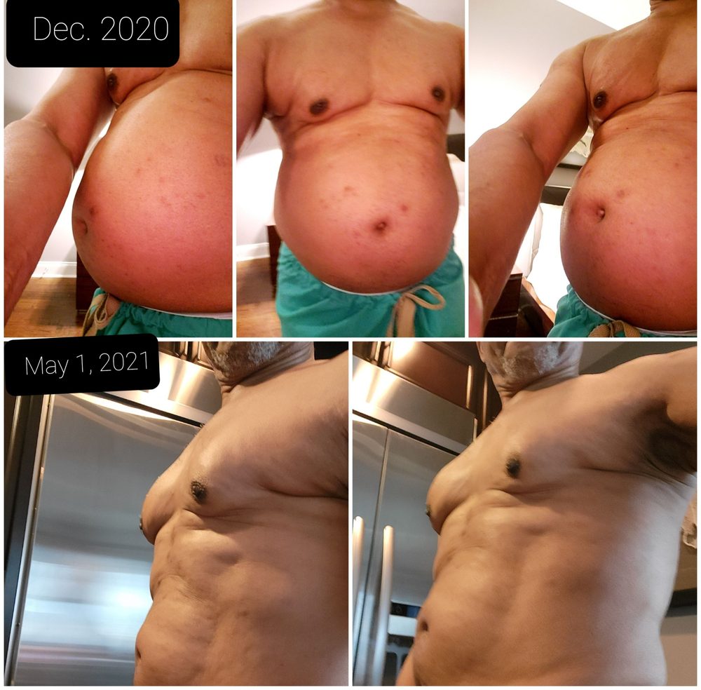 Peachtree Surgical & Bariatrics - patient advocate in Atlanta, GA