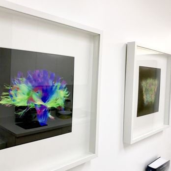 NeuroVella Brain Spa - IV Hydration Near Me - Santa Monica, California NeuroVella Brain Spa - IV Hydration Near Me - Santa Monica, California