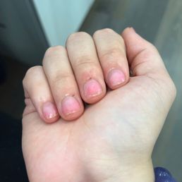 These are my jacked up nails after I told her to remove them she took the nails off by putting a drill full speed. Most painful experience. These are my jacked up nails after I told her to remove them she took the nails off by putting a drill full speed. Most painful experience.