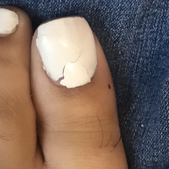 Sky Nails & Lounge - Cracked overlay and shellac chipped - Nail Salons Near Me - Missouri City, Texas Sky Nails & Lounge - Cracked overlay and shellac chipped - Nail Salons Near Me - Missouri City, Texas