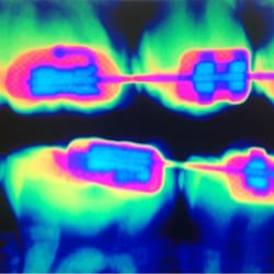 Hudson Kids Dental - X-ray art