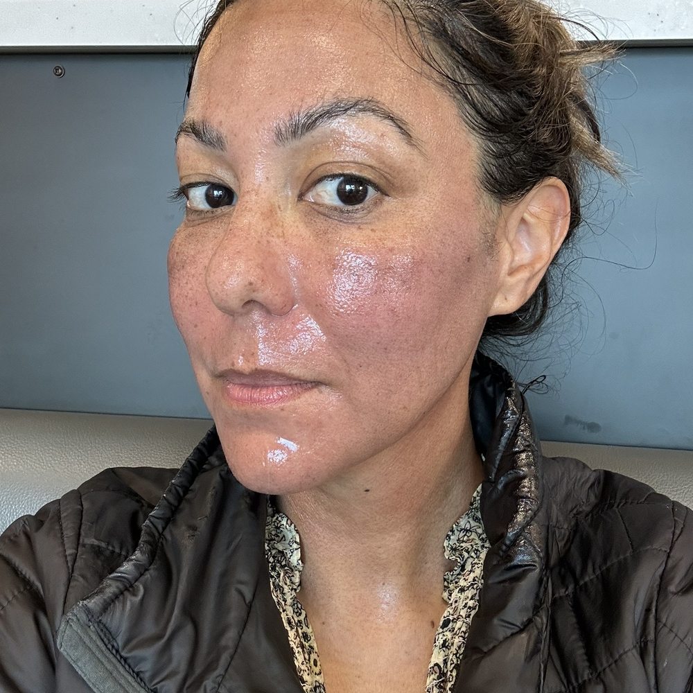 A. David Rahimi, MD, FAAD - Forever Young - Same day of procedure (at Target) - Dermatologists Near Me - Los Angeles, California A. David Rahimi, MD, FAAD - Forever Young - Same day of procedure (at Target) - Dermatologists Near Me - Los Angeles, California