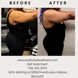 Snatched Wellness IV Hydration & Weight Loss