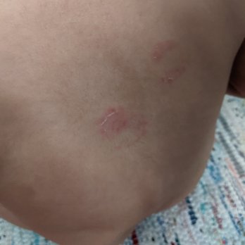 JumpinJax Kids Indoor Playground - Bite marks 2/2 - Preschools Near Me - Paramus, New Jersey