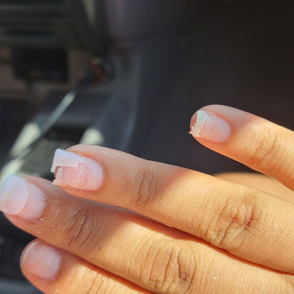 Almond Nails Spa Lounge - Do your self a favor and help this salon to shut down. Look what the did to my nails when I asked to take it off. - Nail Salons Near Me - Kalamazoo, Michigan
