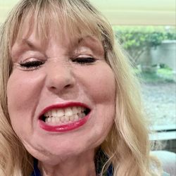 Blue Wave Dental - All my teeth under the Blue Wave Excellence I still get compliments and they are care centered and the dentist are excellent .