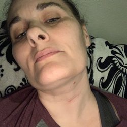 Baylor Scott & White Surgical Hospital - Las Colinas - I'm healing amazingly