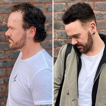 Hair System Salons - Before and after results for hair thinning in men with our premium hair systems. - Hair Loss Centers Near Me - Huntington Beach, California Hair System Salons - Before and after results for hair thinning in men with our premium hair systems. - Hair Loss Centers Near Me - Huntington Beach, California