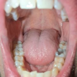 Dr. Dental - Waterbury - Self Teeth