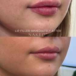 NakedMD - Temecula