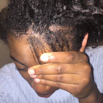 Miracle Wigs & Hair - took out my braids after 5 days. - Hair Loss Centers Near Me - Bronx, New York