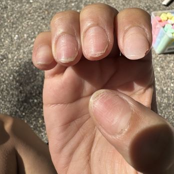 Elegant Nail Spa - Damaged Nails . - Nail Salons Near Me - Kalamazoo, Michigan Elegant Nail Spa - Damaged Nails . - Nail Salons Near Me - Kalamazoo, Michigan