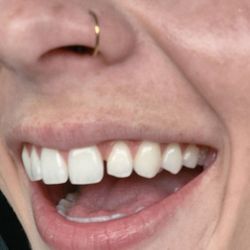 Rancho Dental - Before