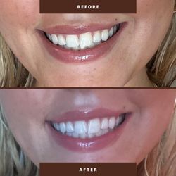 Bella Viso Aesthetics